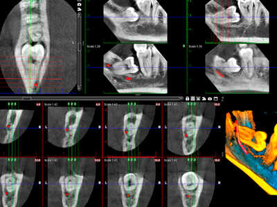 Planmeca ProMax 3D Classic