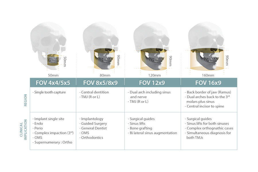 Vatech Green X CBCT | Eclipse Dental : Eclipse Dental