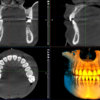 Planmeca ProMax 3D Classic - Image 12