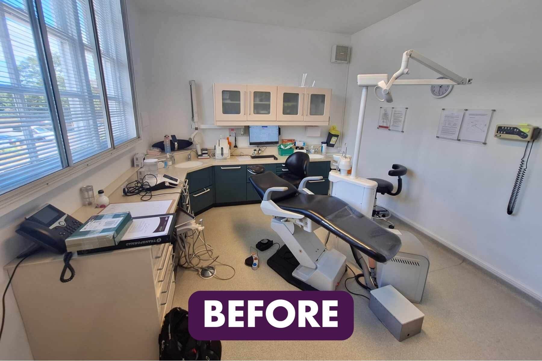 The implant experts surgery before and after 3