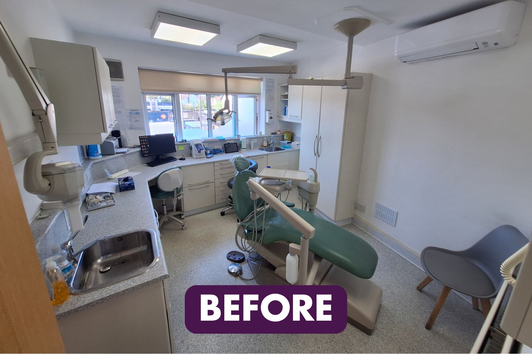 Horton Dental Before chair front side text