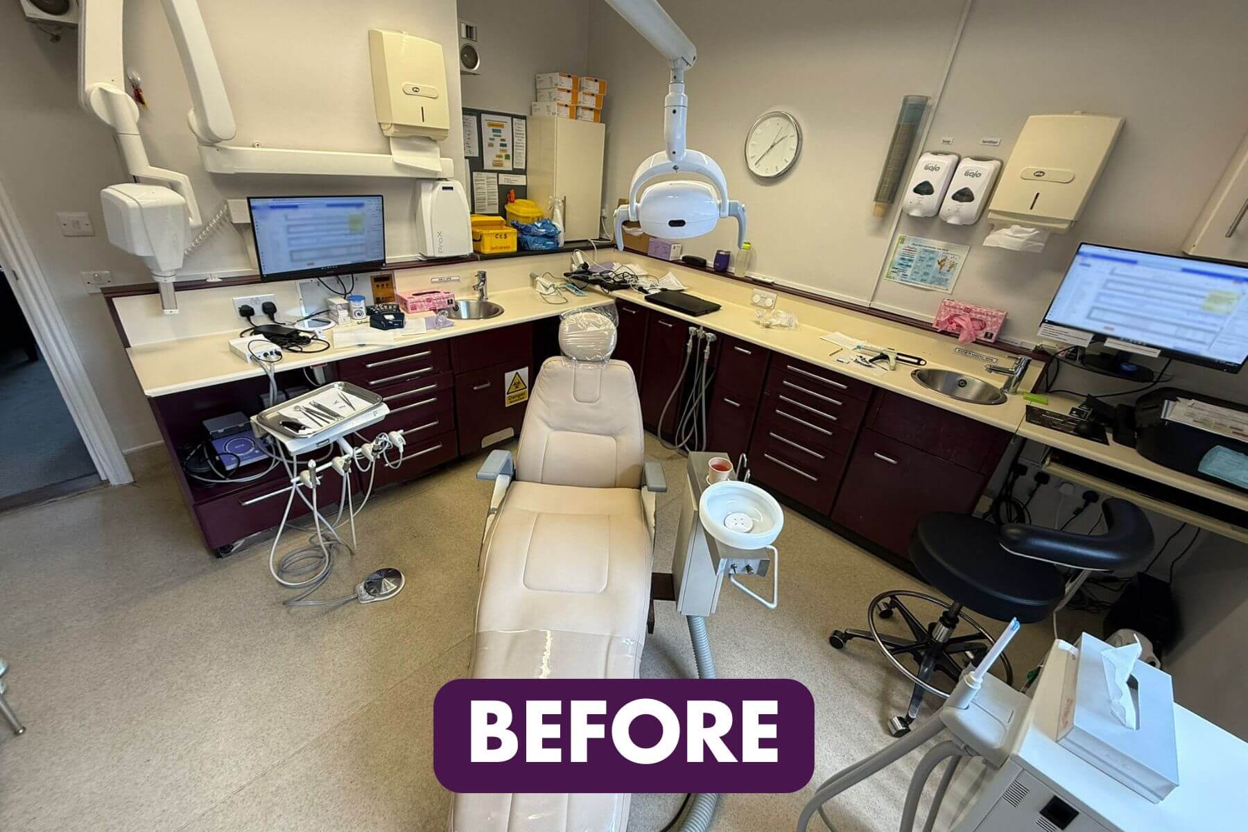 Southcot surgery 2 before main