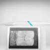 Acteon C50 Full HD Intraoral Camera - Image 5